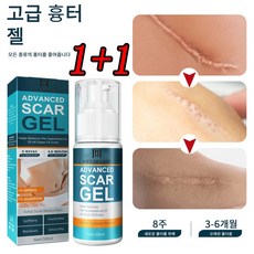 고급 흉터 제거 크림 여드름 여드름 스트레치 마크 리페어 젤 화상 수술 흉터 치료 스무딩 바디 뷰티 스킨 케어, 6개, 50ml