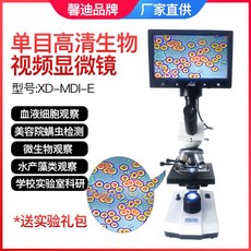 혈관현미경