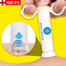 바디로운 모기침 제거기 모기 벌레 물렸을때 물린곳 부음 주사기