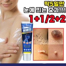 [당일출고] 1+1/2+2 미국기술 피부 치료 제거제 스킨 제거 연고