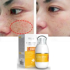 [당일배송/국내산] 천연 성분 저자극 고효율 기미 제거 검버섯 기미크림 미백 기미잡티 화이트닝 색소침착