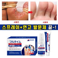 일본 발톱 무좀 치료 연고 문제성 발무좀 제거 스프레이 발가락 가려움 발냄새 완화 세트, 30ml, 1개