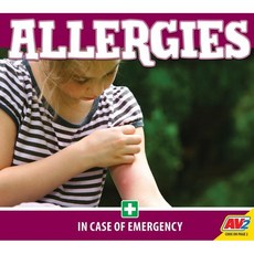 Allergies, Av2 by Weigl