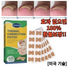 르미노리 효과빠른 내향성발톱테이프 50pcs, 1개, 50개입 - 밴드테이프