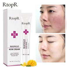 RtopR 여드름 흉터 여드름 없애다 주름 개선 미백 피부 상처 치료 리페어 크림, 15g