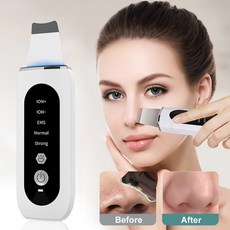 토소웅아쿠아필링기