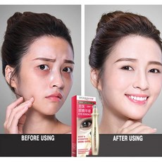 CAICHEN 디자인 아이 세럼 마사지 안주름 제거 다크서클 수분 공급 미백 퍼밍 아이, 1개