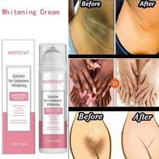팔꿈치미백크림