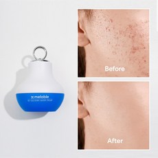 메라블 아크 엑소좀 레이저 여드름 흉터 트러블 색소 침착 연고 피지 홍조 크림