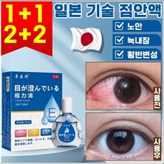 [빠른배송]일본 1+1/2+2 점안액 안구건조증 눈물액 피로해소 황반변성 시력 교정 아이케어