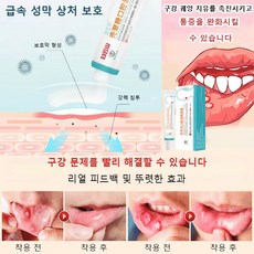 키토산 구강 궤양 리페어 겔 [20g/박스] 인후 통증/ 구강 궤양/ 입냄새/ 구강 및 혀의 궤양/ 구강 세균