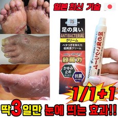 일본기술 발 무좀 치료 약 발바닥 발가락 습진 각질 가려움증 냄새 제거 완화 연고 발 관리 포장증정