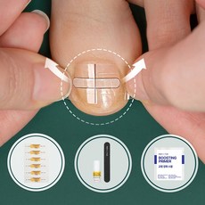 [국내 제조 특허 기술] 퍼펙토 내성발톱 교정기 스트립 자가치료 의료기기 세트