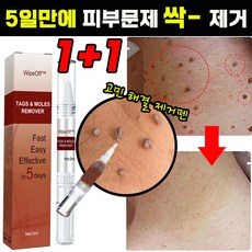 [국내배송] 1+1/2+2 손 발 제거 펜 피부 치료 제거 연고 포장증정