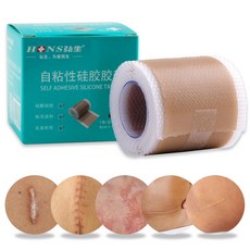 돌출귀교정기
