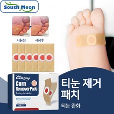 [국내배송]South Moon옥수수 제거 밴드 발 통증 보호 테이프 효과적으로 옥수수를 제거 발 건강을 보호하세요