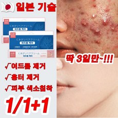 일본 1/1+1 자생크림 여드름 크림 여드름 흉터 제거 연고 여드름 케어 색소침착 선물 랜덤 증정