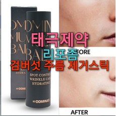 트라넥삼산 TOP01