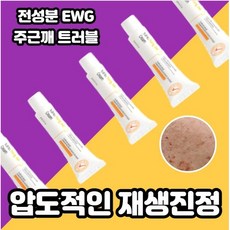 한포진연고