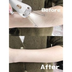 겨드랑이털뽑기