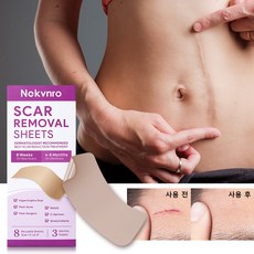 Nekvnro 칼자국 흉터밴드 제왕절개 흉터 화상 수술 흉터 실리콘 젤 가리다 패치 흉터 관리 흉터 커버 흉터 증식 억제 상처의 치유를 촉진하다