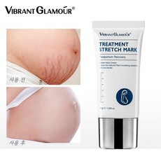 Vibrant Glamour 임산부 튼살 바디 스크래치 케어 크림, 1개, 30g