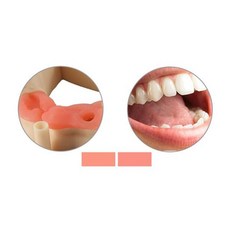 치과3d프린터