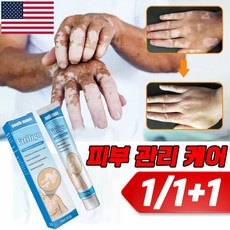 미국기술 1/1+1 백반증 치료 연고 손 목 얼굴 착색 피부치료 연고 20g