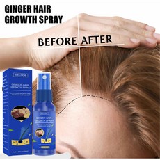 DIDAHOME 생강 헤어 트리트먼트 오일 탈모 영양제 탈모 예방 탈모삼푸 탈모삼푸, 3개, 30ml