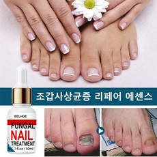 손톱갈라짐영양제