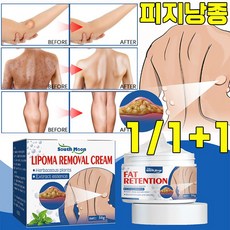 [미국 기술] 피지낭종 연고 피부 표피낭종 제거 연고 지방종 완화 크림 피부과 전용, 1개