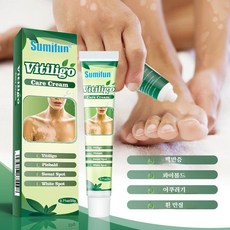 백반증스토리