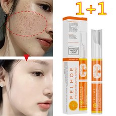 EELHOE 1+1 기미 잡티 크림 얼굴 색소침착 개선 흑자 제거 피부 화이트닝 에센스 톤업 미백, 15ml * 2