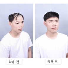 남자가발쇼핑몰