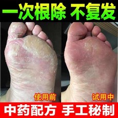 발각질제거기 굳은살 세척 제거 뒤꿈치 씻기 발바닥 닦기 발, 한개옵션1, 한개옵션0