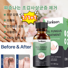 tanksen 조갑사상균증 큐티클 에센스 진균 리페어에센스 생안발 리페어 겔 에센스 1+1*30ml, 30ml*5