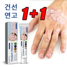 1+1 피부가려움증 연고 지루성피부염 모낭염 연고 여드름 크림