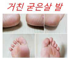 뒤꿈치각질제거 뒷꿈치관리 발바닥관리 각질싹 아기발 패디플래너 3+1, 4개, 1개입