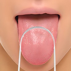 프랜베이 혀바닥 크리너 백태 제거기 혀클리너 1세트, 1개