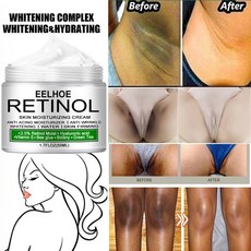 복부지방분해크림