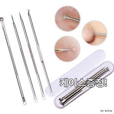 여드름뿌리뽑기