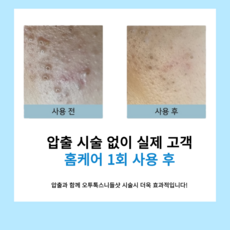 니들샷 리들샷 스피큘 앰플 세럼 모공필링 각질 피부탄력 물광 오투톡스필 약초필 해초칠