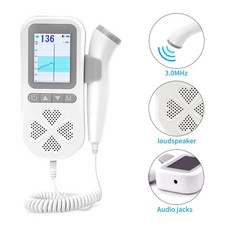 태아심음측정기 태아도플러 초음파 심박수 모니터 임신 소리 하트 비트 음파 탐지기 USB 충전식 없음 30MHz, 1개