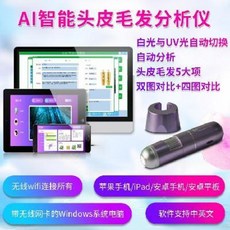 두피카메라 유분 수분 피부 머리카락 진단기 AI 지능형 고화질 무선 WIFI 두피 모발, 01 제비꽃