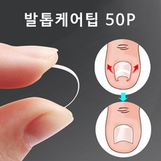 내성발톱교정팁