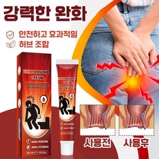 [빠른배송 1/1+1] 항문 가려움 소양증 치료 연고 사타구니 통증 출혈 완화 크림