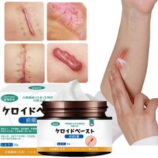 흉터 연고 피부 흉터 복원 및 개선 1개 상품 이미지