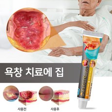 욕창연고 효과적 개선 욕창 피부궤양 화상