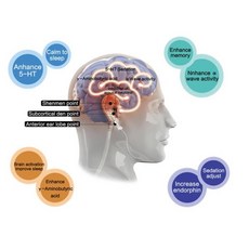 편두통 불면증 우울증 불안 치료 건강 관리 CES Cranial Electrotherapy 자극 수면 불면증 장치, 01 CHINA_02 Eu 플러그