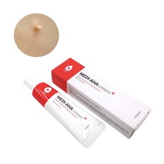 눈가비립종셀프제거